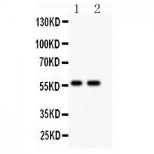 E3 SUMO-protein ligase PIAS4 Antibody