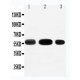 EAAT3 Antibody