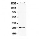 Endomucin Antibody