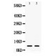 Eotaxin 3 Antibody