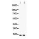 Eotaxin Antibody