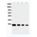 Eotaxin Antibody