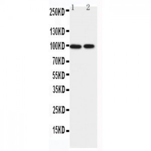 EPB41L1 Antibody