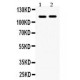 Eph receptor A5  Antibody