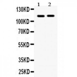 Eph receptor A5  Antibody