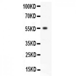 EPO Receptor Antibody