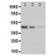 ErbB 3 Antibody