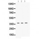 ERVW-1  Antibody