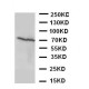 Estrogen Receptor beta Antibody