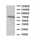 Estrogen Receptor beta Antibody