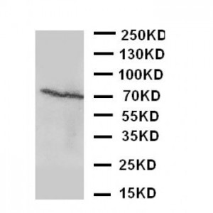 Estrogen Receptor beta Antibody