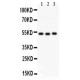 Factor VII Antibody