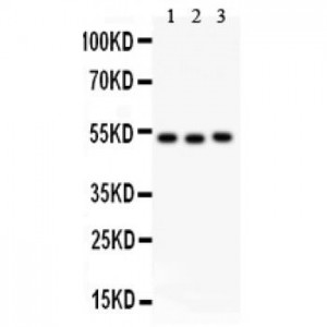 Factor VII Antibody