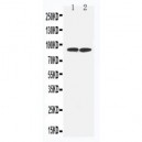 FAK Antibody