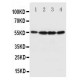 Fascin Antibody