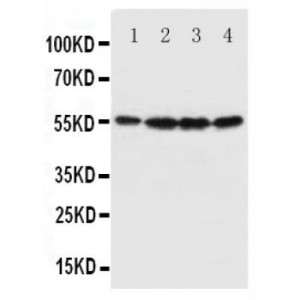 Fascin Antibody