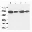 FES Antibody