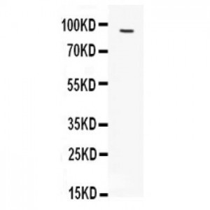 FES Antibody