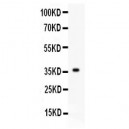 FGF1  Antibody