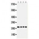 FGF22 Antibody