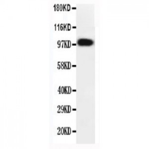 FGFR2 Antibody