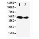 Flt3 ligand Antibody