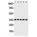 Fos B Antibody