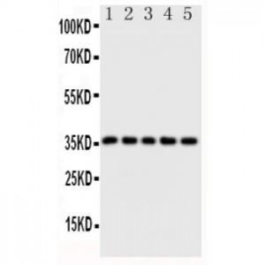 Fos B Antibody