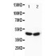 FOXP3 Antibody