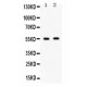 GABRB3  Antibody