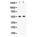 GABRB3  Antibody