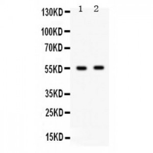 GABRB3  Antibody