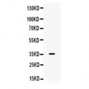 galectin 9  Antibody