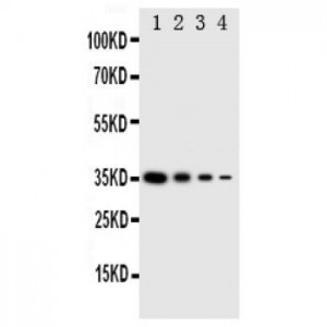 GCN2 Antibody