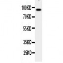 GCSF Receptor Antibody