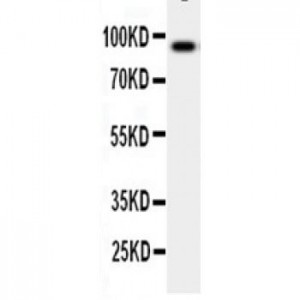 GCSF Receptor Antibody