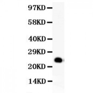 GDNF  Antibody