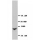 GJB2 Antibody