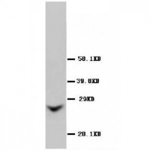 GJB2 Antibody