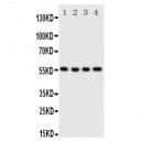 Glucose Transporter 5 GLUT5 Antibody