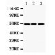 Glucose Transporter GLUT1 Antibody