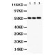 GLUT9 Antibody