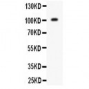 Glutamate Receptor 1 Antibody