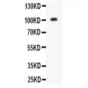 Glutamate Receptor 1 Antibody