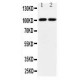 Glutamate receptor 3 Antibody