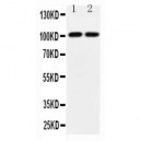 Glutamate receptor 3 Antibody