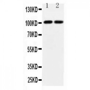 Glutamate receptor 3 Antibody