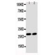 Glutathione S Transferase theta 1 Antibody