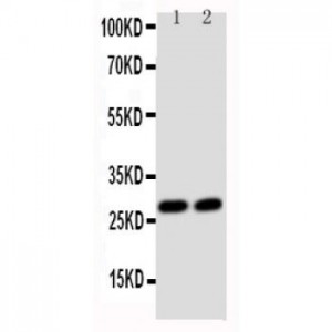 Glutathione S Transferase theta 1 Antibody