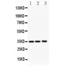 GM-CSF Antibody